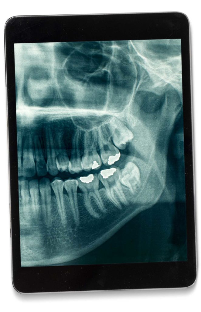 Studio Dentistico Galassini - Panoramica Digitale